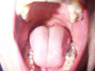 mouth.jpg